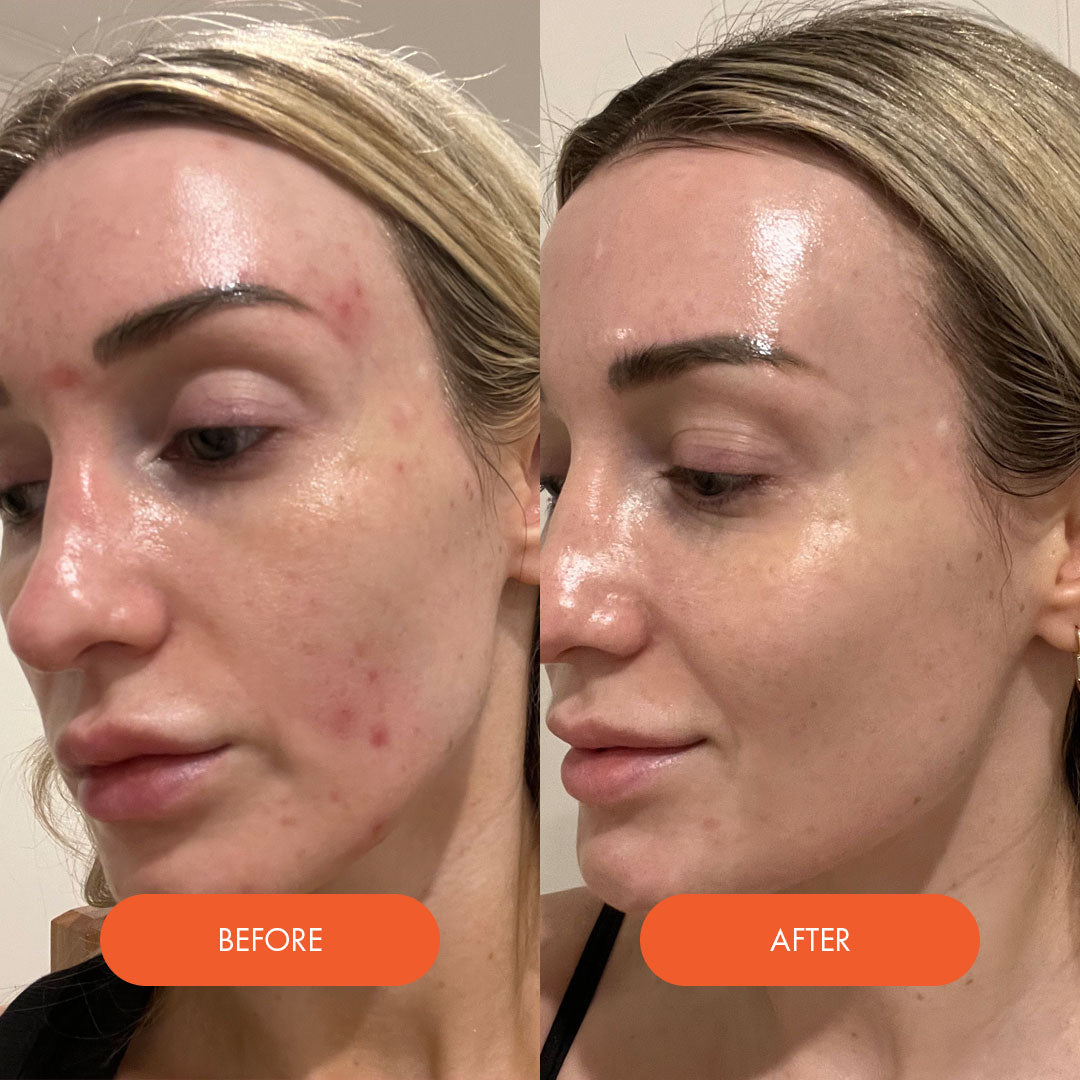 LED Silicone Radiant Mask - Face, Neck & Décolletage