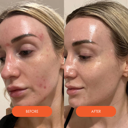 LED Silicone Radiant Mask - Face, Neck & Décolletage